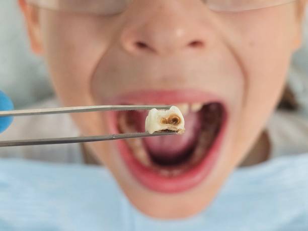 Best Emergency Cosmetic Dentistry (e.g., broken veneers) in Kamiah, ID